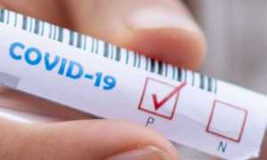 covid positivo test