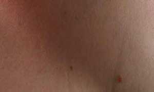 dermatologo