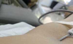 donazione sangue