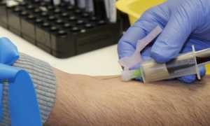 prelievo sangue