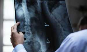 radiografia foto