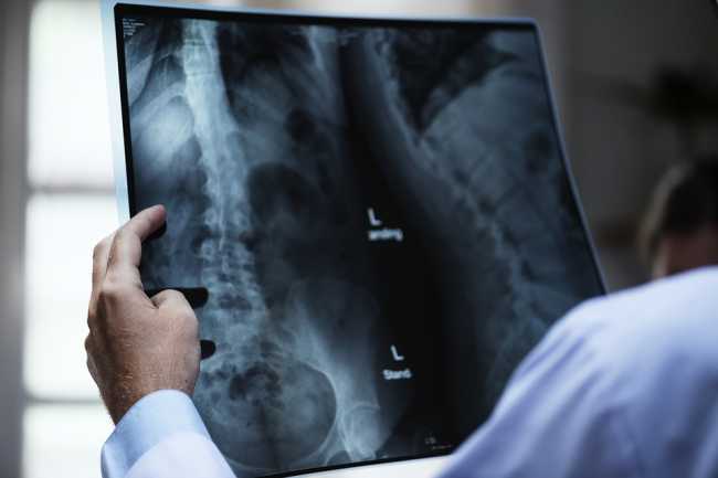 radiografia foto