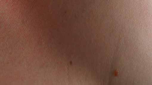 dermatologo